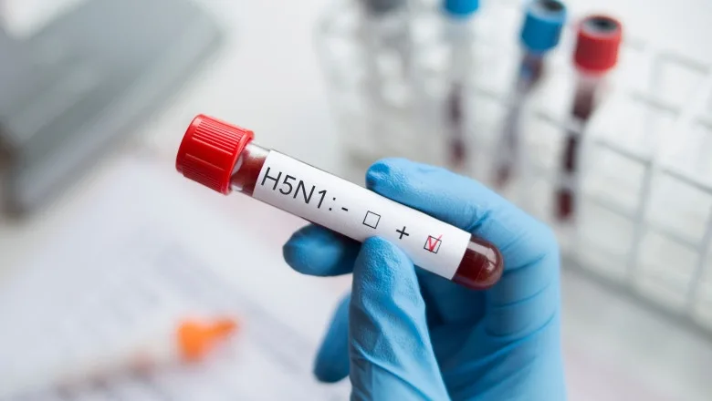 Caz fără precedent în Europa: virusul gripei aviare H9N2, confirmat la un pacient