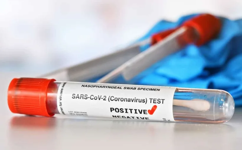 Coronavirus România: 2.096 cazuri în ultimele 24 de ore