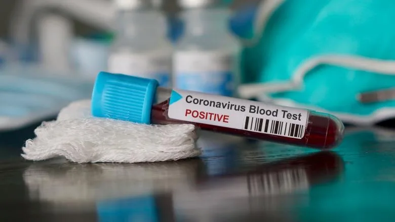 327 de cazuri noi, în ultimele 24 de ore. Bilanțul infecțiilor cu noul coronavirus ajunge la 12.567